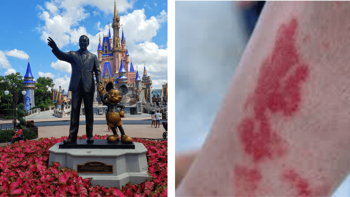 disney rash