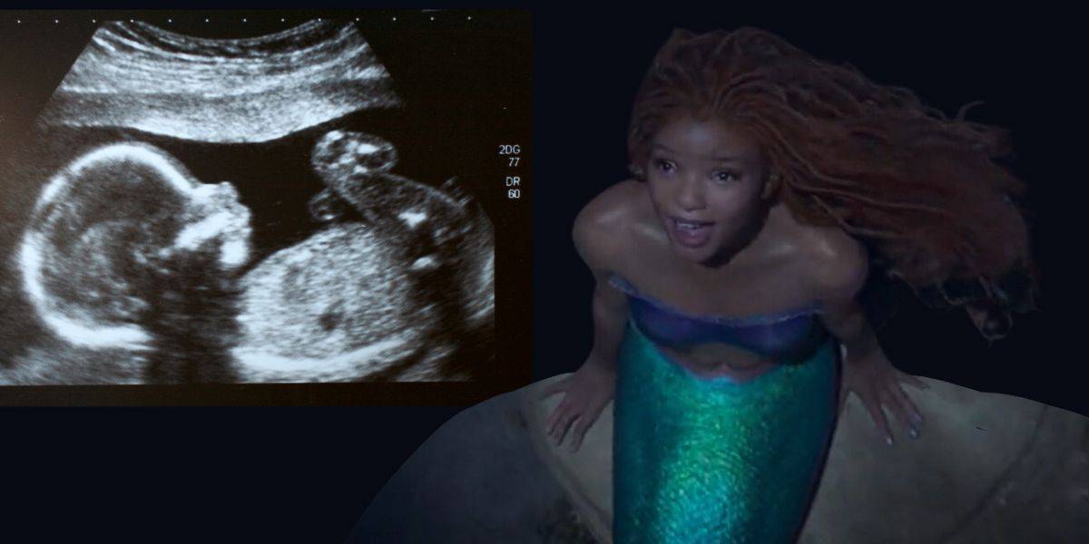 Halle Bailey Pregnant